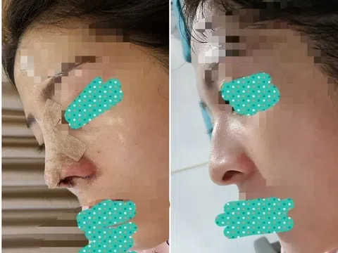 Trải nghiệm 'kinh hoàng' của khách hàng tại Viện thẩm mỹ y khoa Dr. Hải Lê 